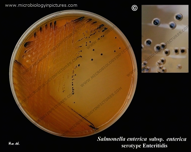 salmonella colonies on salmonella-shigella agar